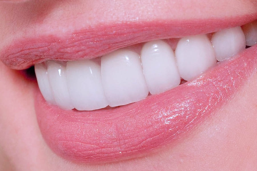 Протезирование передних зубов верхней и нижней челюсти