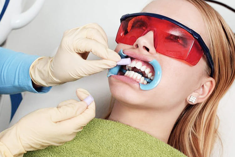 Почему болят зубы после отбеливания?